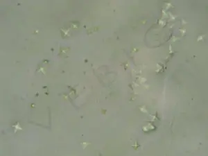 Cristaux d’oxalate de calcium dans les urines d’un chien intoxiqué par de l’antigel (ethylene glycol) (photo laboratoire Vebio)