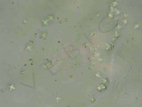 Cristaux d’oxalate de calcium dans les urines d’un chien intoxiqué par de l’antigel (ethylene glycol) (photo laboratoire Vebio)