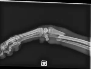 Radiographie de chien qui a eu la patte brisée après s’être fait marcher dessus par un enfant